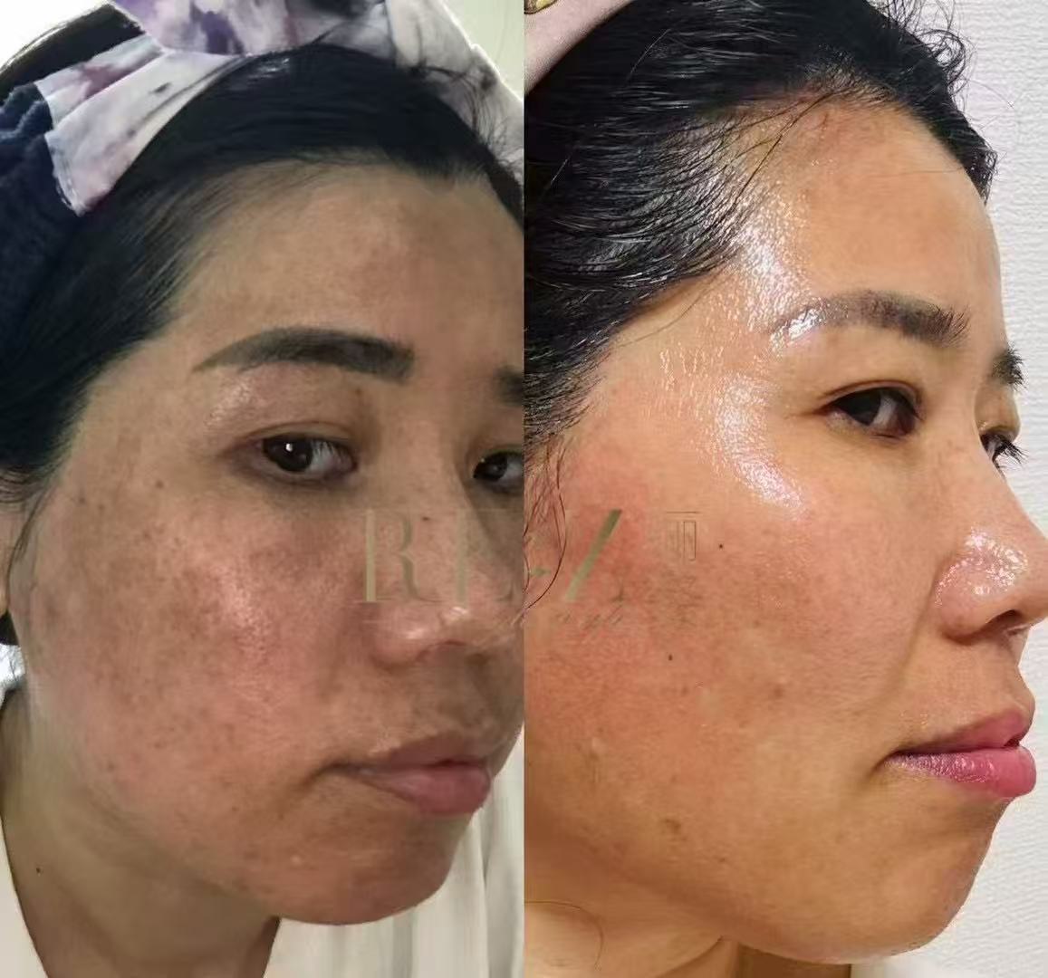 RIZの施術ルーム（イメージ）