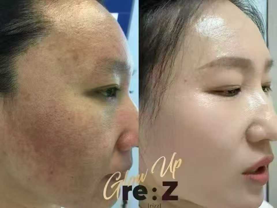 RIZの施術ルーム（イメージ）