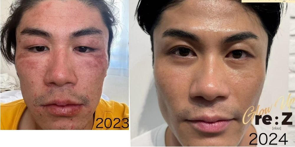 RIZの施術ルーム（イメージ）